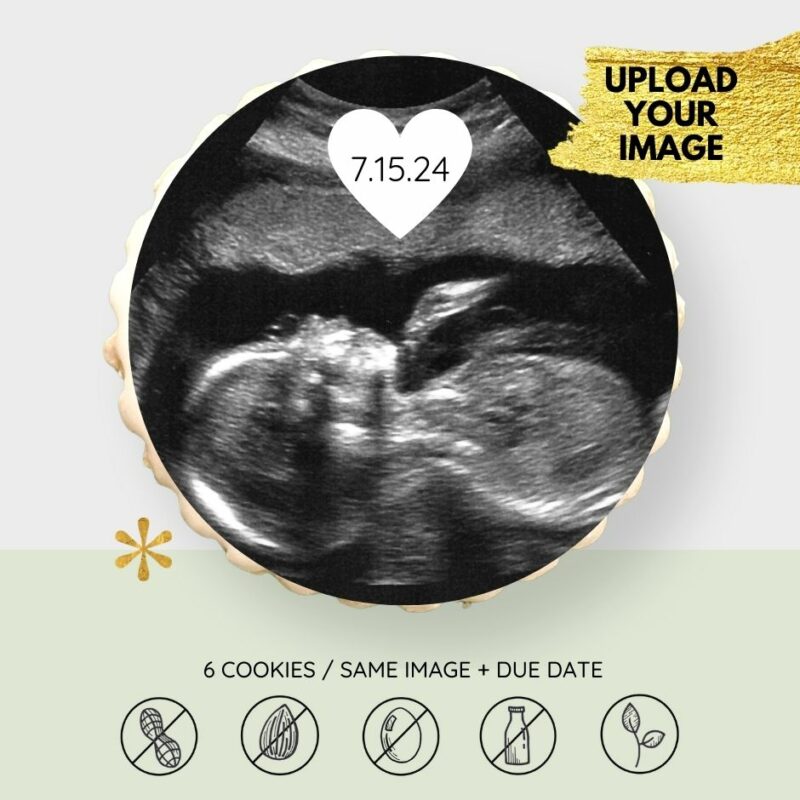 Ultrasound Photo Cookies
